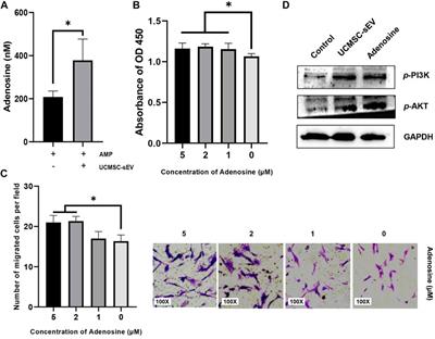 CD73-Positive Small Extracellular Vesicles Derived From Umbilical Cord Mesenchymal Stem Cells Promote the Proliferation and Migration of Pediatric Urethral Smooth Muscle Cells Through Adenosine Pathway